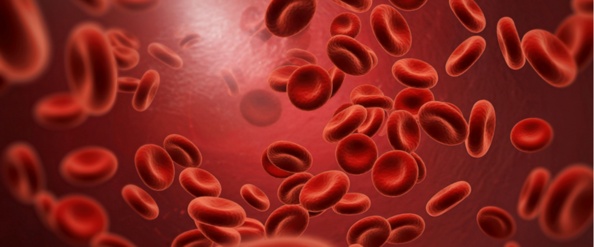 Anemia